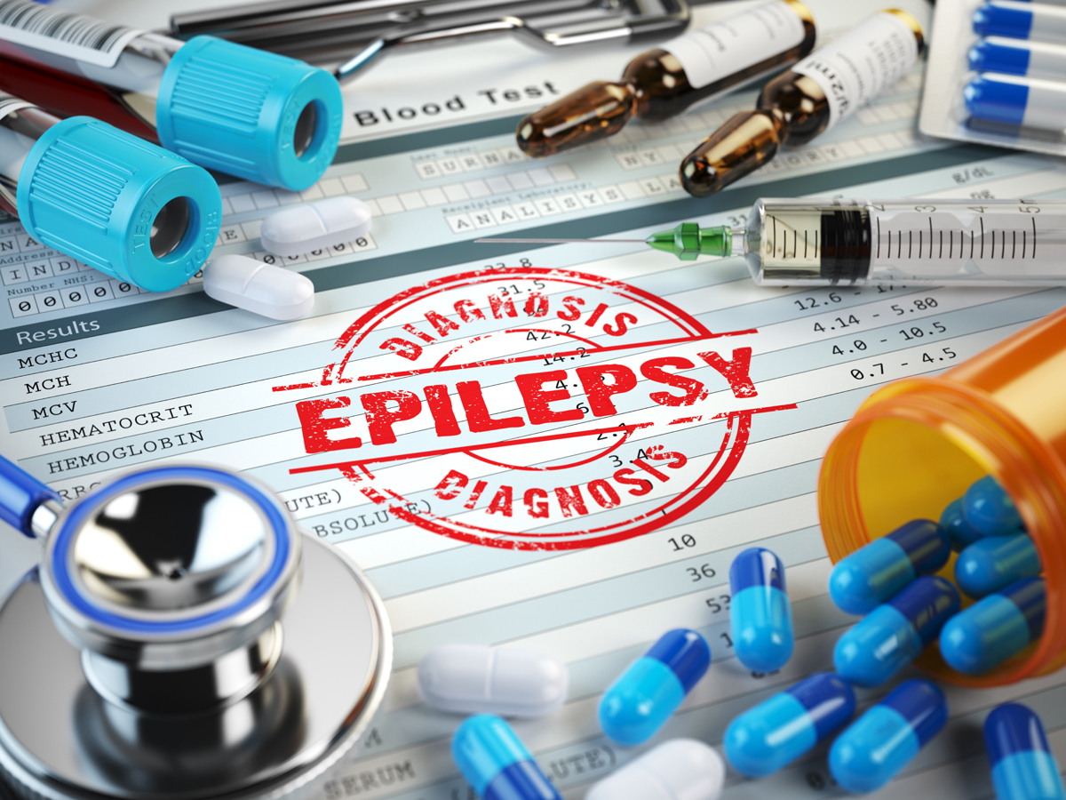 Epilepsy